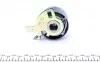 Комплект ГРМ Citroen C5/C6/C8/Fiat/Ford/Peugeot 2.2HDI 06- HEPU 20-1692 (фото 4)
