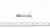 Комплект ГРМ Hyundai Santa Fe/Tucson 2.0/2.2 CRDi 01-12 KAVO PARTS DKT-3004 (фото 2)